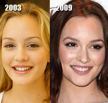 jillian michaels before and after. Jillian Michaels Cosmetic