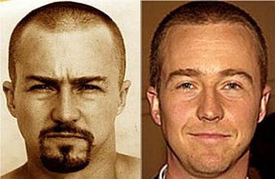 edward norton hair transplant before and after photos - plastic surgery proof dot com