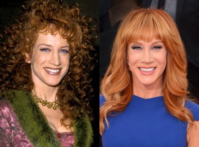 Kathy Griffin plastic surgery before and after
