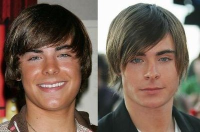 zac efron before and after plastic surgery
