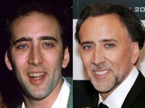 nicolas cage plastic surgery Image 9