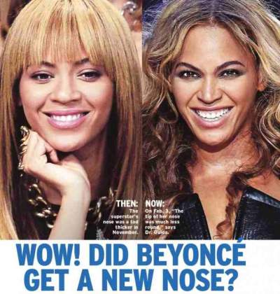 beyonce plastic surgery before and after photos