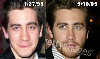 jake gyllenhaal plastic surgery before and after