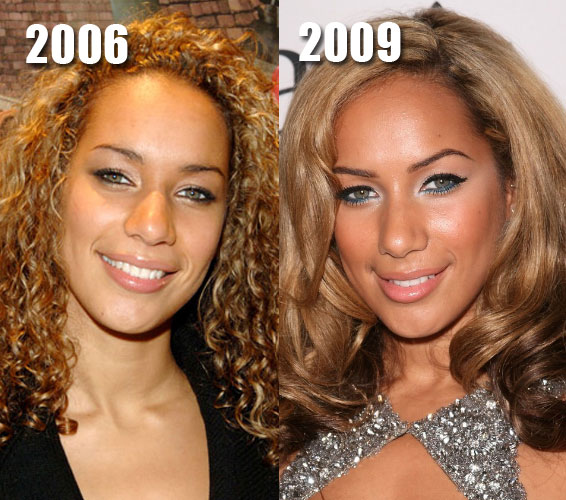 Leona Lewis Plastic Surgery: Nose Job Before and After Photos Famewatcher.