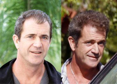 mel gibson hair transplant then and now2