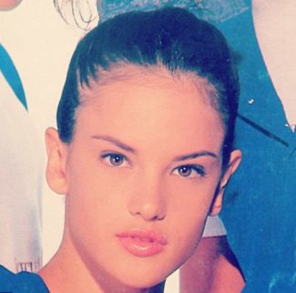 alessandra-ambrosio-ears-before-and-after