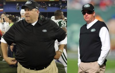 rex ryan lap band surgery - before and after photos