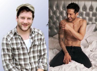 matt cardle hair transplant before and after2