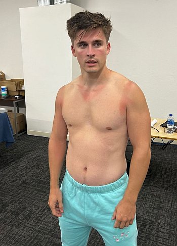 ludvig aberg shirtless actually ludwig ahgren